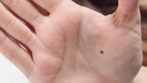 Lucky Moles On Female Body: महिलाओं के शरीर पर तिल होने का क्या है रहस्य, जान सकते हैं भाग्य?