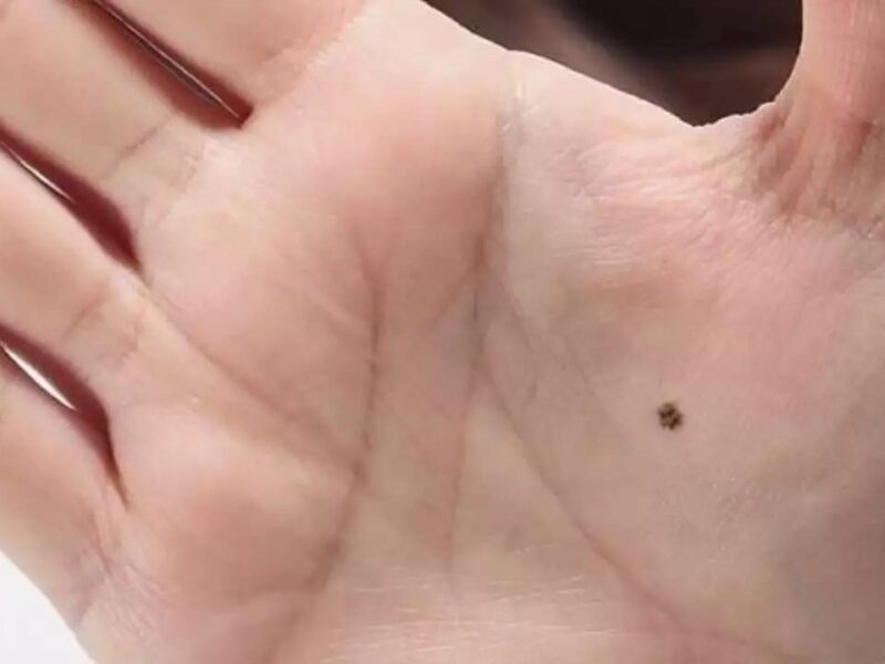 Lucky Moles On Female Body: महिलाओं के शरीर पर तिल होने का क्या है रहस्य, जान सकते हैं भाग्य?